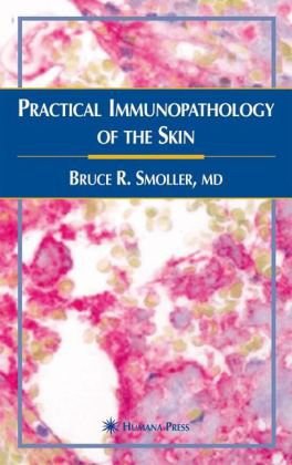 Practical Immunopathology of the Skin pdf epub mobi 电子书 下载