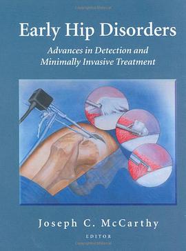 Early Hip Disorders pdf epub mobi 电子书 下载
