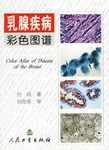 乳腺疾病彩色图谱 pdf epub mobi 电子书 下载