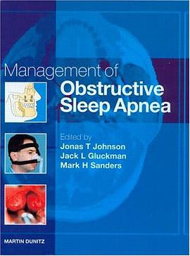 Obstructive Sleep Apnoea