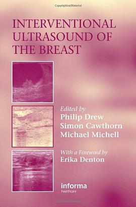 Interventional Ultrasound of the Breast pdf epub mobi 电子书 下载