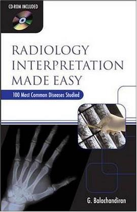 Radiology Interpretation Made Easy pdf epub mobi 电子书 下载