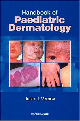 Handbook of Paediatric Dermatology pdf epub mobi 电子书 下载
