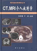 CT、MRI介入放射学
