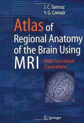 Atlas of Regional Anatomy of the Brain Using MRI pdf epub mobi 电子书 下载
