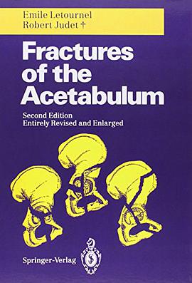 Fractures of the Acetabulum pdf epub mobi 电子书 下载