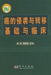 癌的侵袭与转移基础与临床 pdf epub mobi 电子书 下载