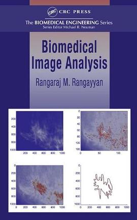 Biomedical Image Analysis pdf epub mobi 電子書 下載