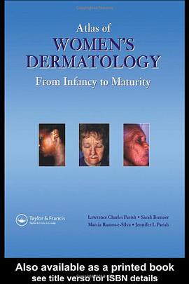 Atlas of Women's Dermatology pdf epub mobi 电子书 下载