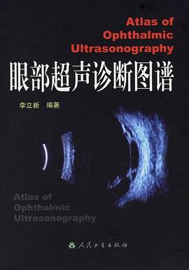 眼部超声诊断图谱 pdf epub mobi 电子书 下载
