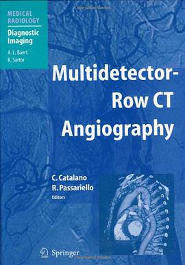 Multidetector-Row CT Angiography pdf epub mobi 下载