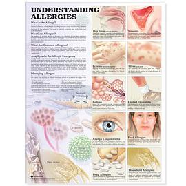 Understanding Allergies Anatomical Chart pdf epub mobi 电子书 下载