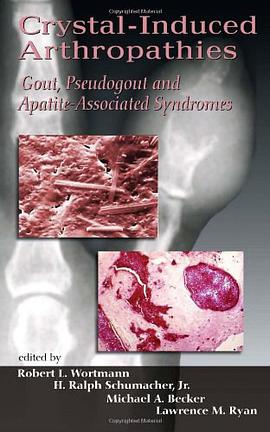 Crystal-induced Arthropathies pdf epub mobi 电子书 下载