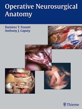 Operative Neurosurgical Anatomy pdf epub mobi 电子书 下载