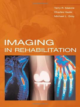 Imaging in Rehabilitation pdf epub mobi 电子书 下载