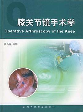 膝关节镜手术学