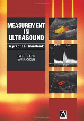 Measurement in Ultrasound pdf epub mobi 电子书 下载