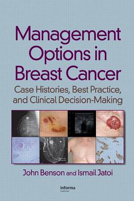 Management Options in Breast Cancer pdf epub mobi 电子书 下载