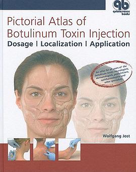 Pictorial Atlas of Botulinum Toxin Injection pdf epub mobi 電子書 下載