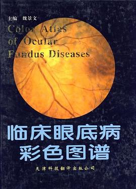 臨床眼底病彩色圖譜 pdf epub mobi 電子書 下載