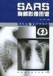 SARS胸部影像图谱 pdf epub mobi 电子书 下载