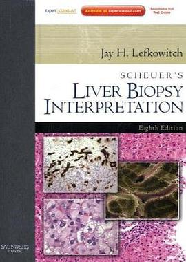 Scheuer's Liver Biopsy Interpretation