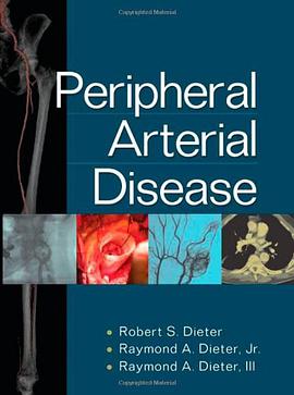 Peripheral Arterial Disease pdf epub mobi 電子書 下載