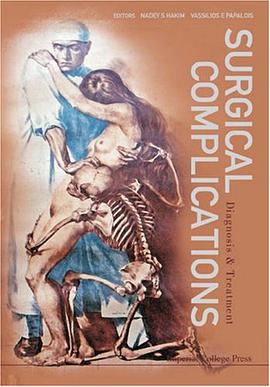 Surgical Complications pdf epub mobi 电子书 下载