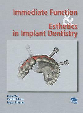 Immediate Function & Estetics in Implant Denistry pdf epub mobi 电子书 下载