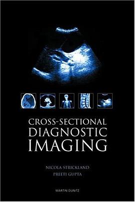 Cross-Sectional Diagnostic Imaging pdf epub mobi 电子书 下载