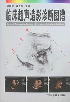 临床超声造影诊断图谱 pdf epub mobi 电子书 下载