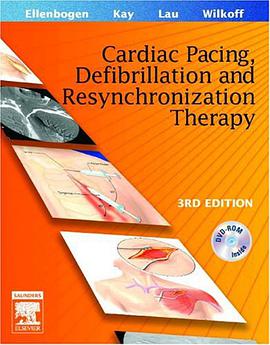 Clinical Cardiac Pacing, Defibrillation and Resynchronization Therapy pdf epub mobi 电子书 下载