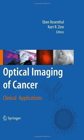 Optical Imaging of Cancer pdf epub mobi 电子书 下载
