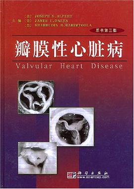 瓣膜性心脏病 pdf epub mobi 下载