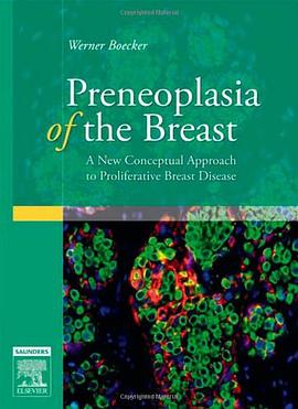 Preneoplasia of the Breast pdf epub mobi 电子书 下载