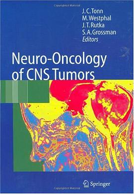 Neuro-Oncology of CNS Tumors pdf epub mobi 电子书 下载