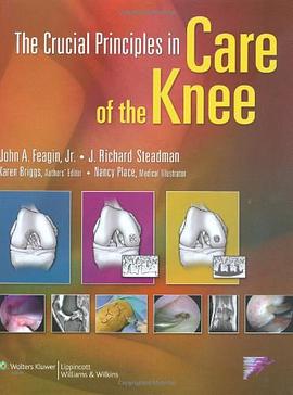 The Crucial Principles in Care of the Knee pdf epub mobi 电子书 下载