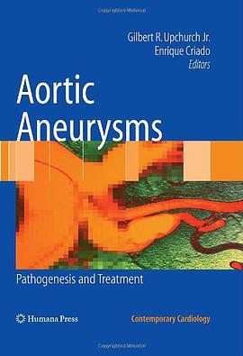 Aortic Aneurysms pdf epub mobi 电子书 下载
