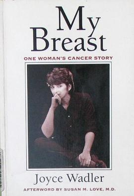My Breast pdf epub mobi 电子书 下载