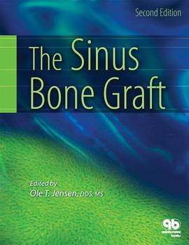 Sinus Bone Graft pdf epub mobi 电子书 下载