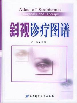 斜视诊疗图谱