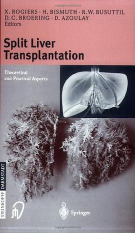 Split Liver Transplantation pdf epub mobi 电子书 下载