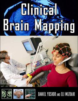 Clinical Brain Mapping pdf epub mobi 电子书 下载