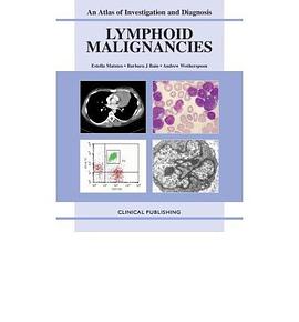 Lymphoid Malignancies pdf epub mobi 电子书 下载