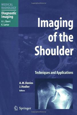 Imaging of the Shoulder pdf epub mobi 电子书 下载