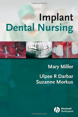 Implant Dental Nursing pdf epub mobi 电子书 下载