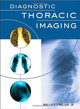 Diagnostic Thoracic Imaging pdf epub mobi 电子书 下载