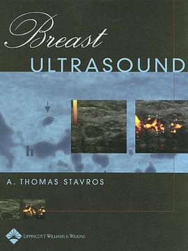 Breast Ultrasound pdf epub mobi 电子书 下载