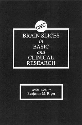Brain Slices in Basic and Clinical Research pdf epub mobi 电子书 下载