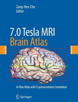 7.0 Tesla MRI Brain Atlas pdf epub mobi 电子书 下载